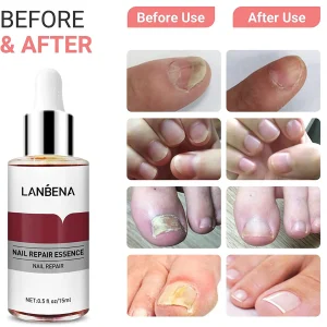 سرم تقویت کننده ناخن لانبنا LANBENA
