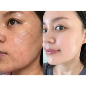 فوم براش دار گریپ فروت و ویتامین سی نوآکنه NO ACNE